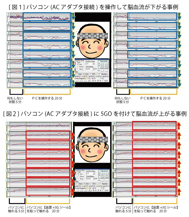 電磁波対策　5GO