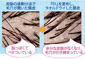 イリアール01　頭皮