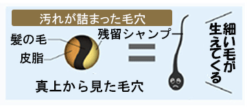 イリアール01