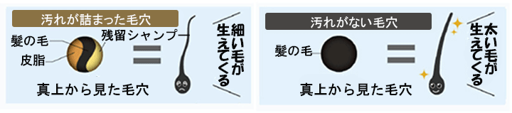 イリアール01　頭皮クレンジングで太い毛を育てる