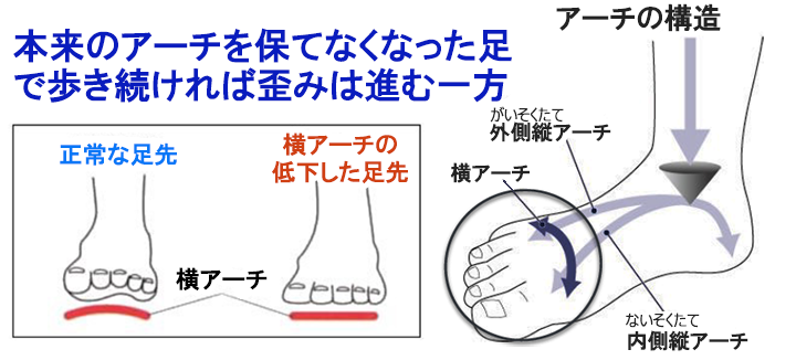 ヤノリング